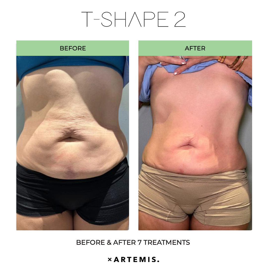 TShape2-SlimContour-01