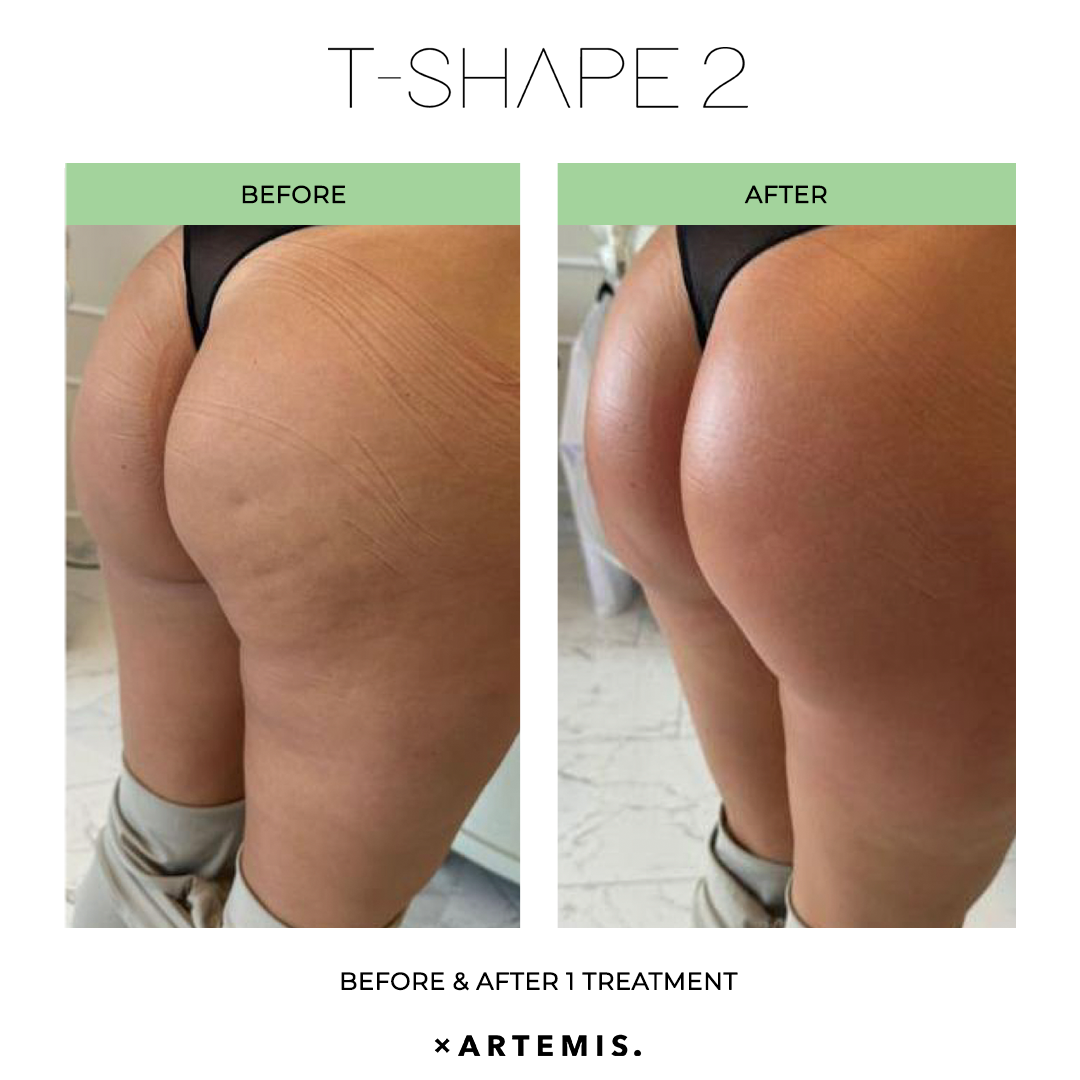 TShape2-SlimContour-06
