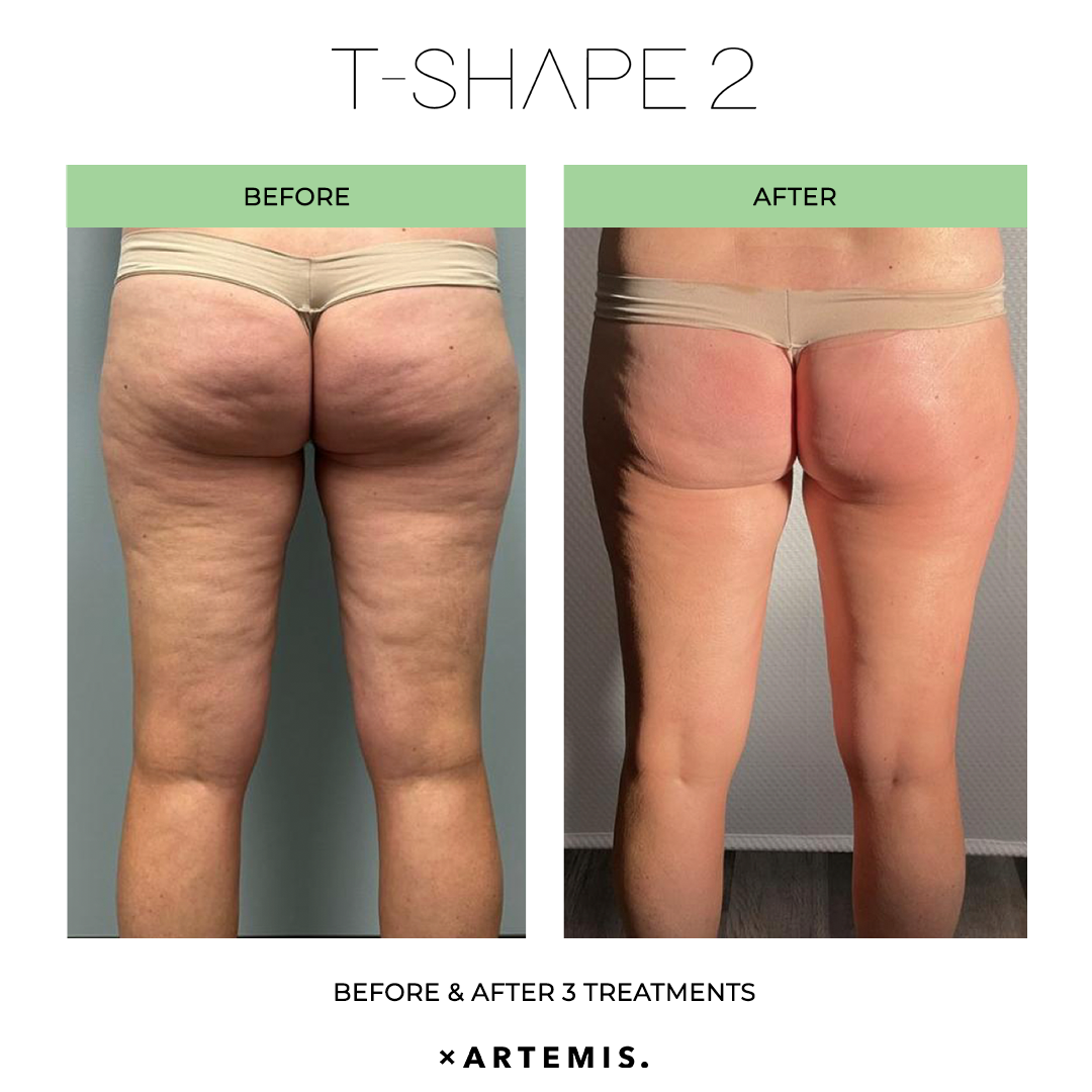 TShape2-SlimContour-07