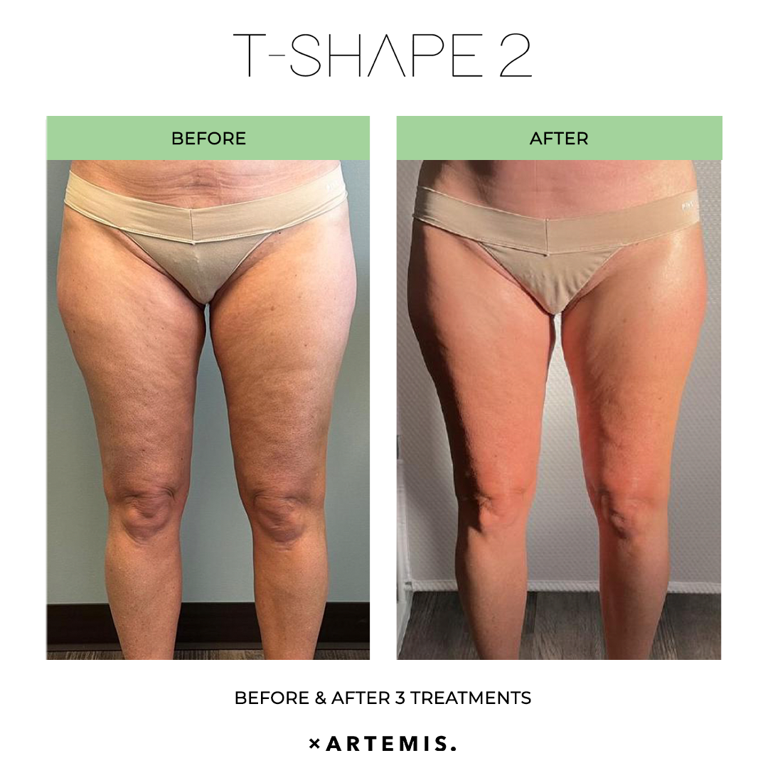 TShape2-SlimContour-08