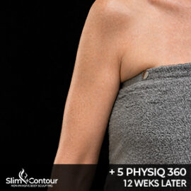Everesse Physiq 360 - Arm Before